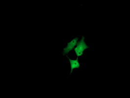 CESK1 Antibody