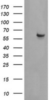 CESK1 Antibody