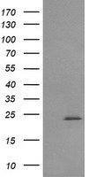 RAB30 Antibody
