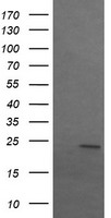 SRY Antibody