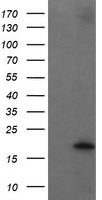 UBE2G2 Antibody