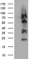 ZNF447 Antibody