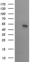 STK38L Antibody