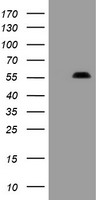 PHF7 Antibody