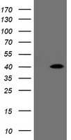 ZC2HC1A Antibody