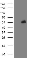 PHF7 Antibody