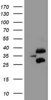 UBC6e Antibody