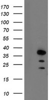 AIP Antibody
