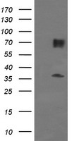 Estrogen Related Receptor gamma Antibody