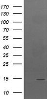 TPD52L3 Antibody