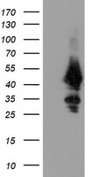 UBE2J1 Antibody