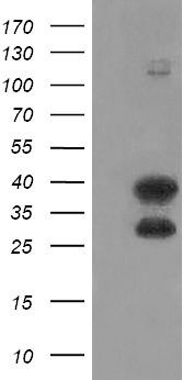 UBC6e Antibody