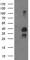 UBC6e Antibody