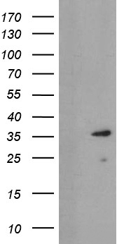 UBE2J1 Antibody