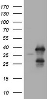 UBE2J1 Antibody