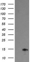 Tumor protein D52 like 3 Antibody