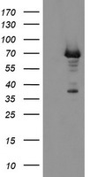 PGM3 Antibody
