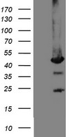Mannose Phosphate Isomerase Antibody