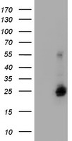 UBE2E3 Antibody