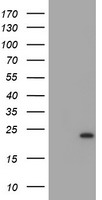 UBE2E3 Antibody