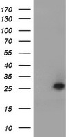 UBE2E3 Antibody