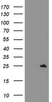 C21ORF56 Antibody