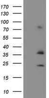 CYB5R1 Antibody