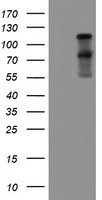 PSMA Antibody