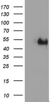 LIM1 Antibody