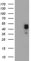 LHX1 Antibody