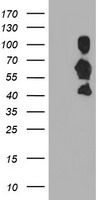 SCHIP1 Antibody