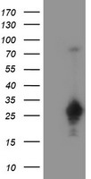 Protein C inhibitor Antibody