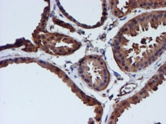 Cystatin C (CST3) antibody