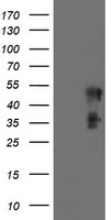 SCHIP1 Antibody