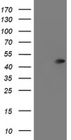 Protein C inhibitor Antibody