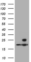 PSMB9 Antibody