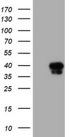 Protein C inhibitor Antibody