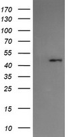 Protein C inhibitor Antibody