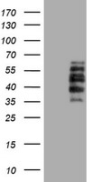 Dystrobrevin beta Antibody