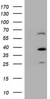 Dystrobrevin beta Antibody