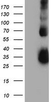 TIMP2 Antibody