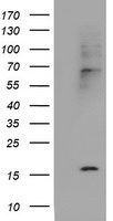 Cystatin SA Antibody