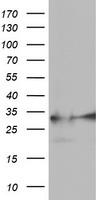 EXOSC7 Antibody