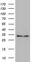 EXOSC7 Antibody