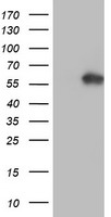 AKT1 Antibody