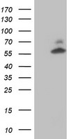 AKT1 Antibody
