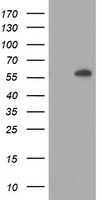 AKT1 Antibody