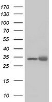 EXOSC7 Antibody