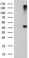 AGPAT5 Antibody