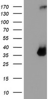 TPSG1 Antibody